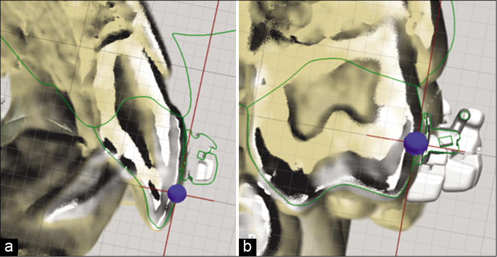(a) Splicing of the scan and tomography with the bracket for axe assessment, (b) splicing of the scan and tomography with a tube for axe evaluation.