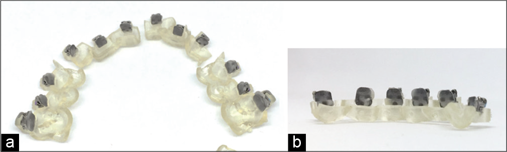 (a and b) Composite base fabricated on bracket bonding surface using 3D printed model from Figure 19, 20.