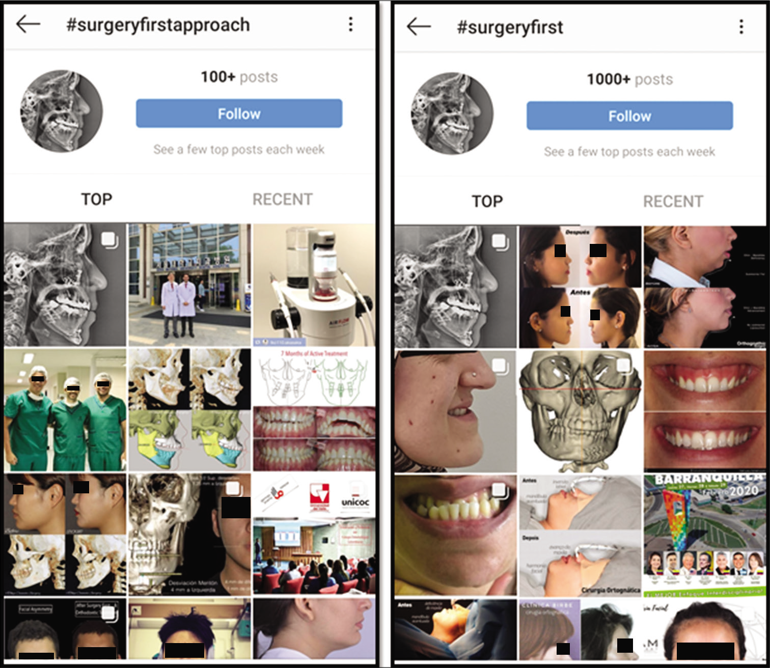 Results of the search terms #surgeryfirst and #surgeryfirstapproach on Instagram.