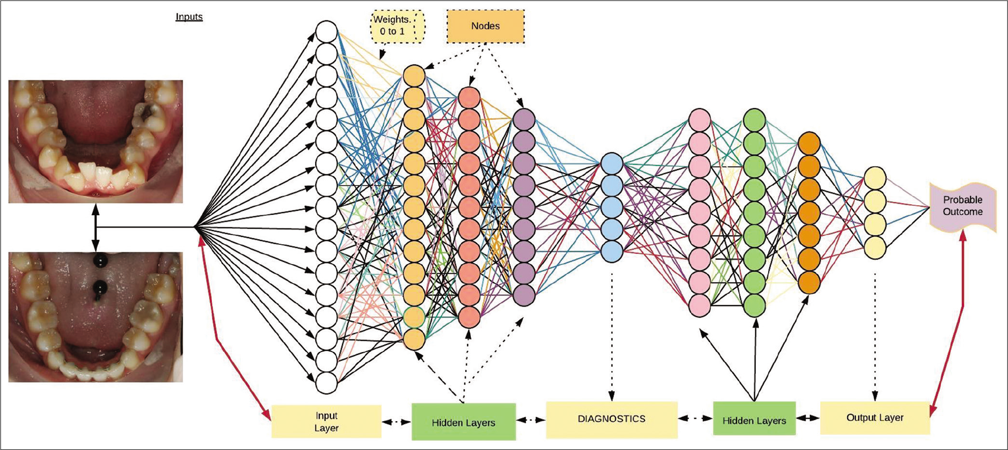 Deep neural network. The variables on the left are input into nodes. Random weights are allocated to the layers and allow the network to “learn” by back propagation.