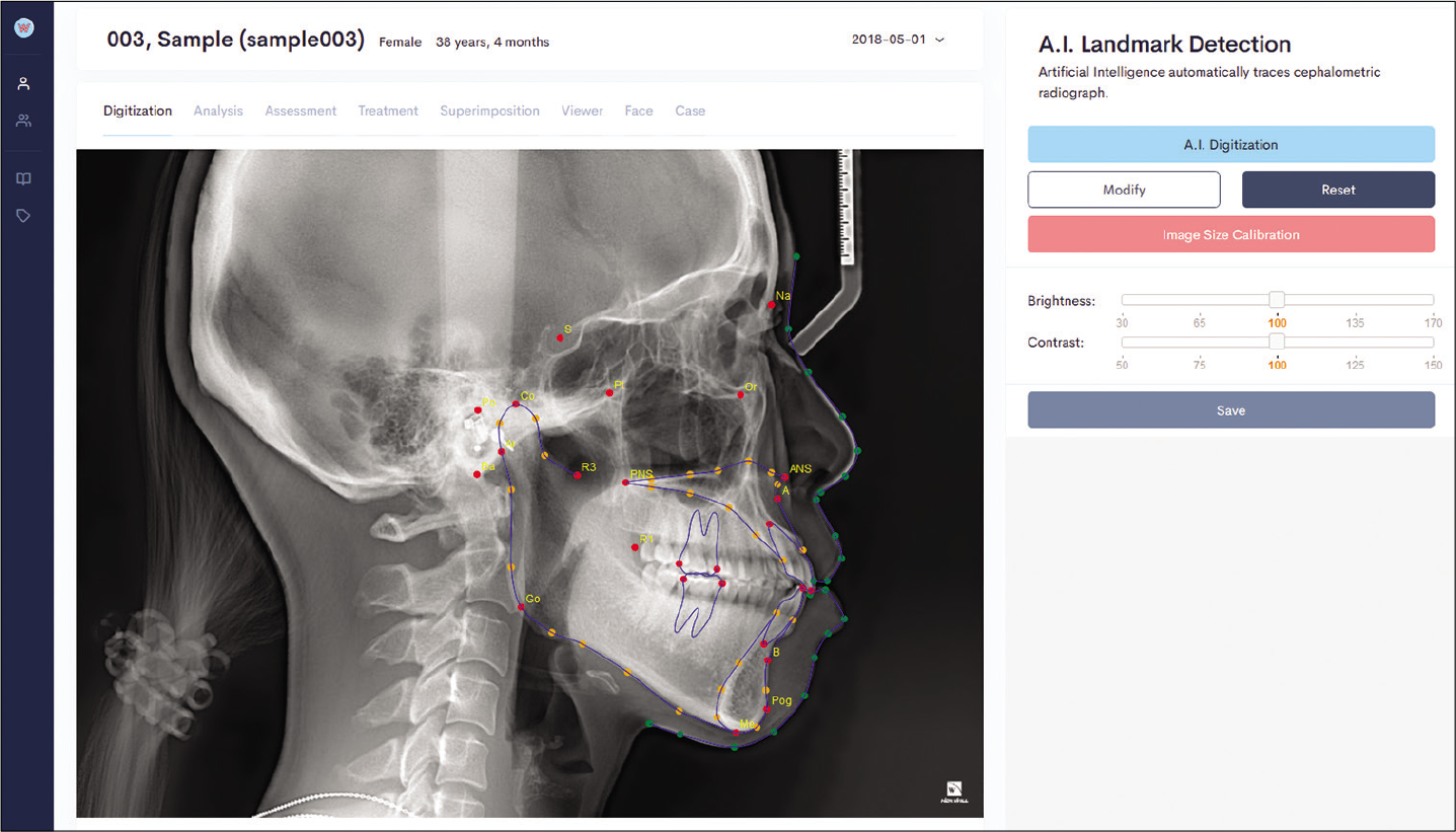 Cephalometric automatic point detection.