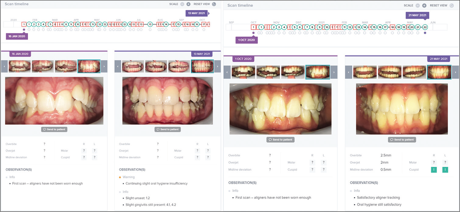 Dental monitoring (Paris, France) utilizes artificial intelligence application designed for remote monitoring of dental treatment and management.