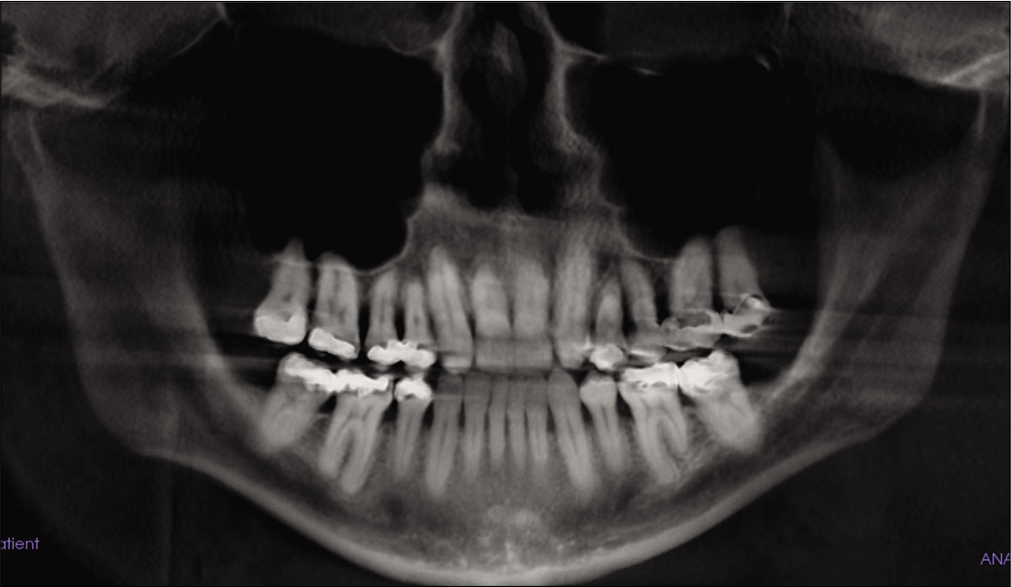 Pre-treatment panoramic X-ray.