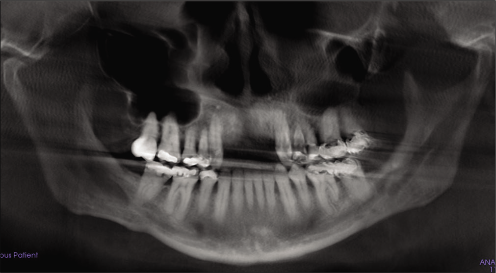 Post-treatment panoramic X-ray.