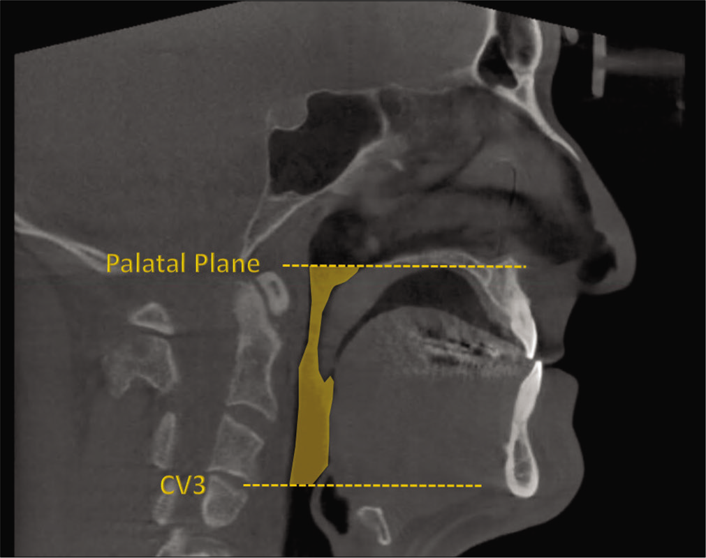 CBCT landmarks.