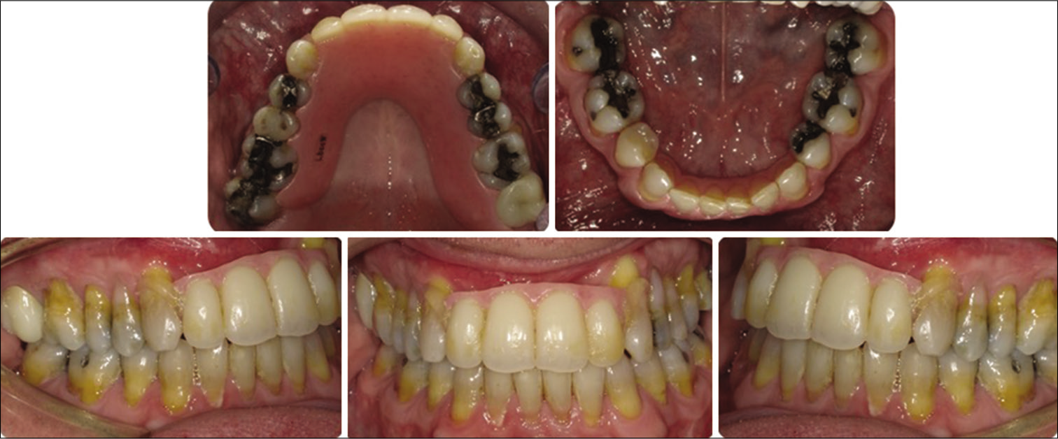 Post-treatment intraoral photos.