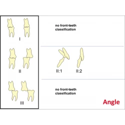 Article figure