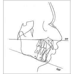 Article figure