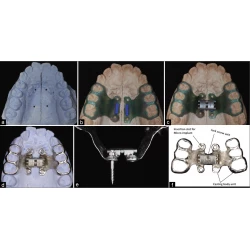 Article figure