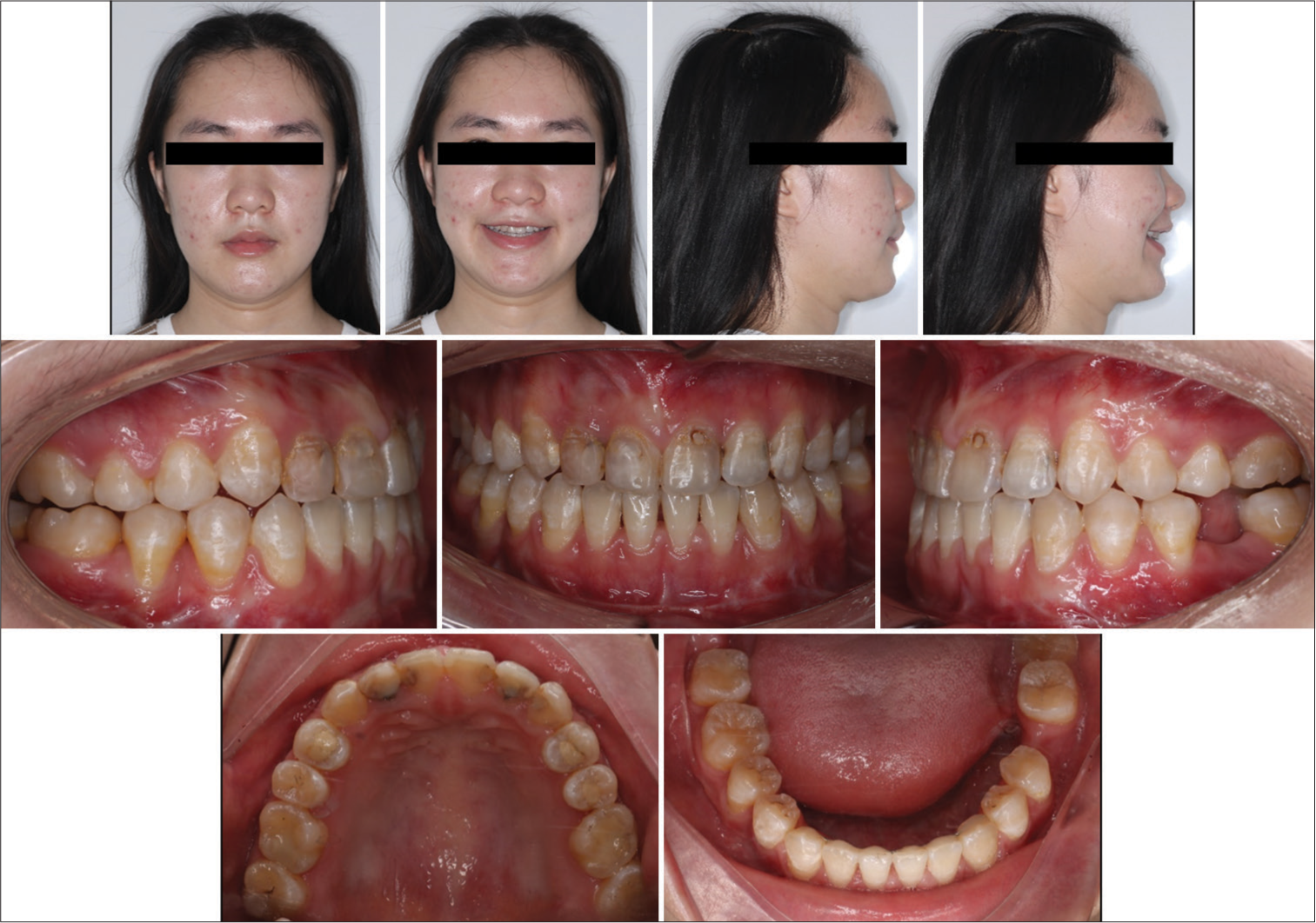 Post-treatment facial and intraoral photographs.