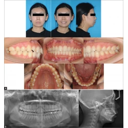 Article figure