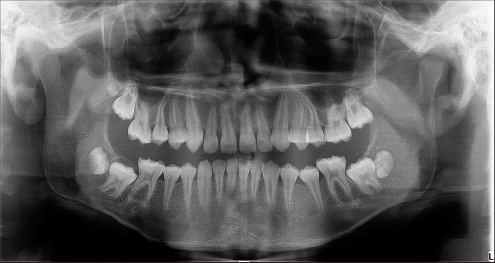 Pre-treatment dental panoramic tomograph.