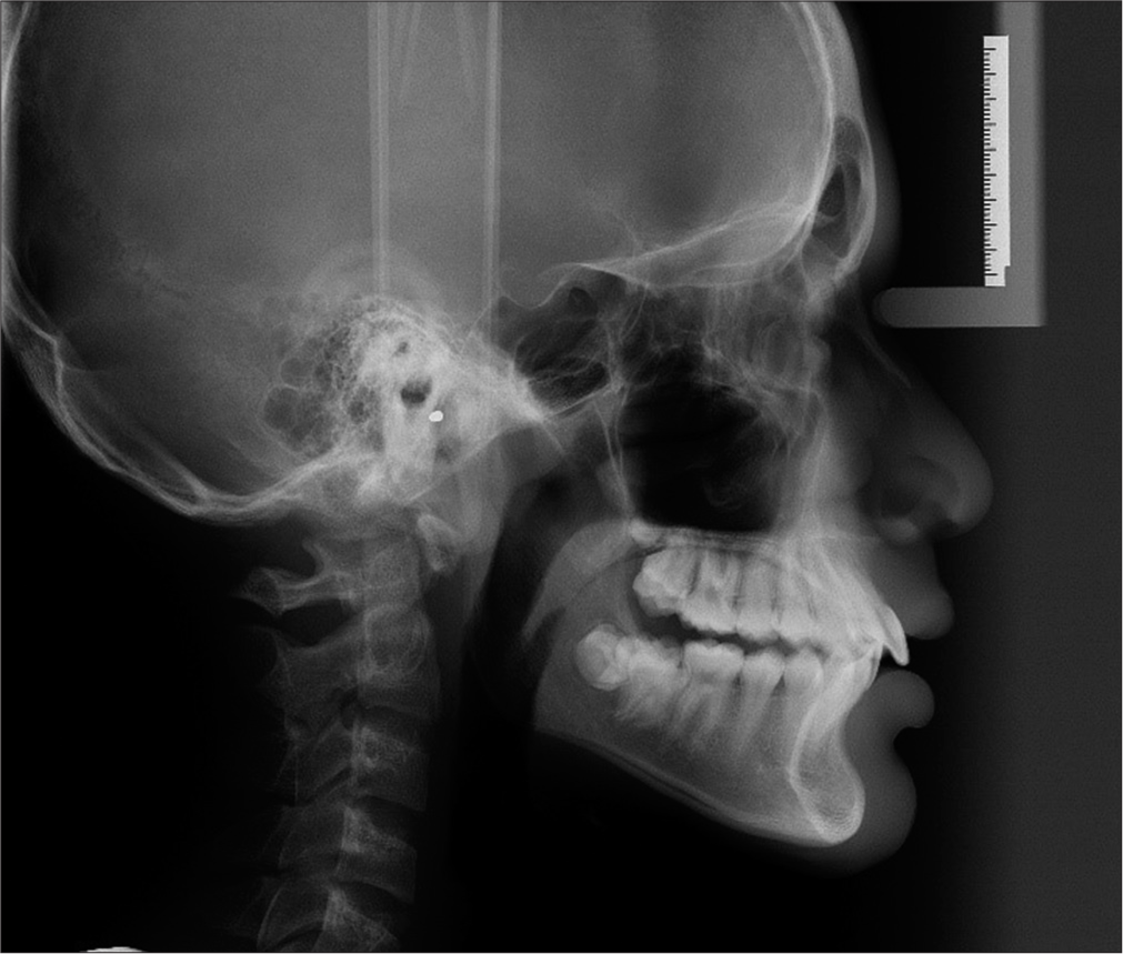 Post-treatment lateral cephalogram.