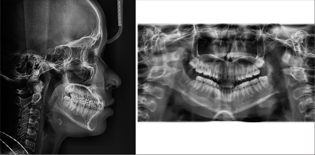 Pre-treatment X-rays.