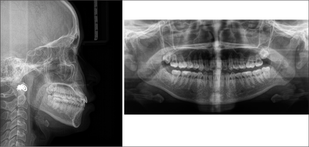 Post-treatment X-rays.