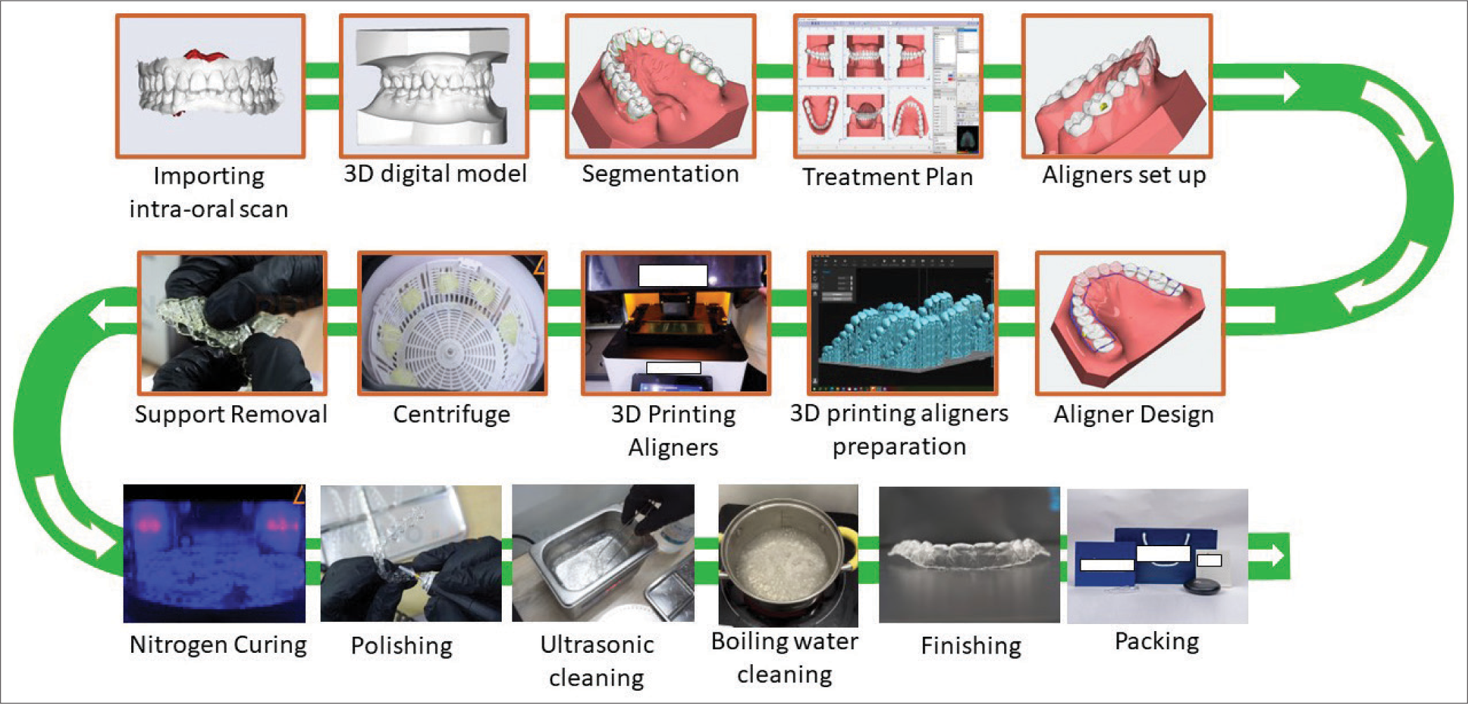 Laboratory procedure for in-house aligner production.