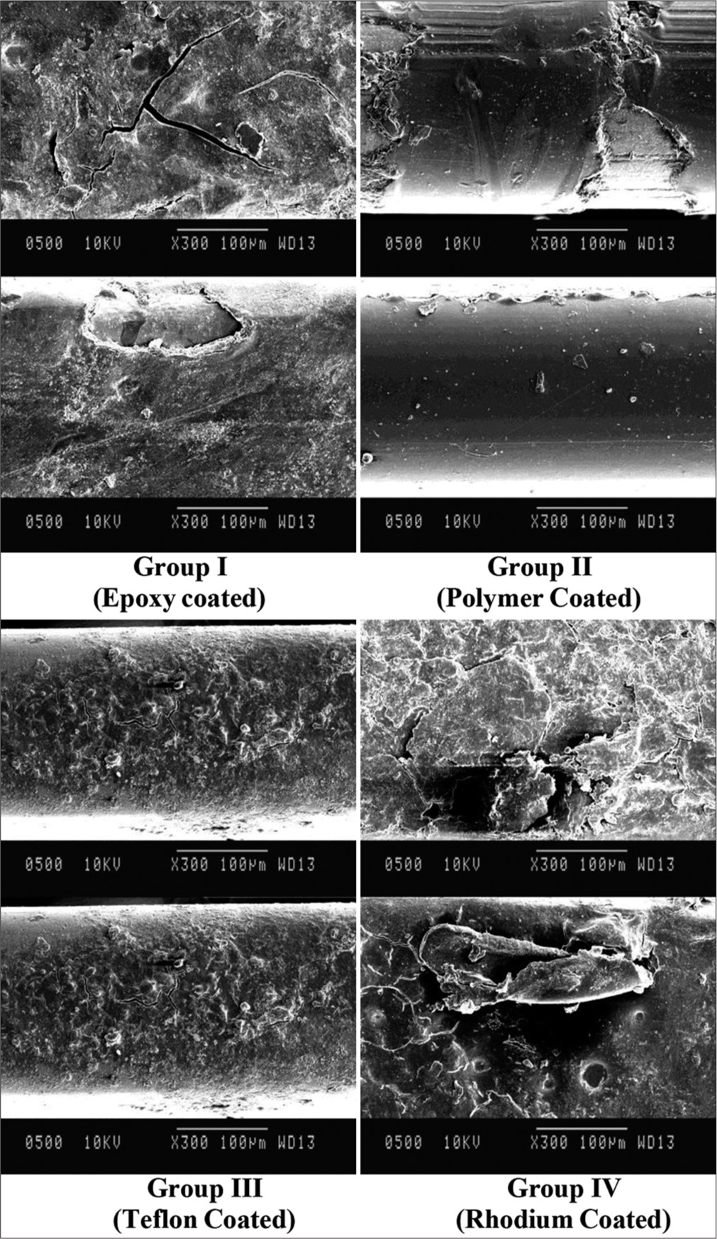 Scanning electron microscope pictures of esthetic-coated archwires at ×300 magnification after oral exposure.