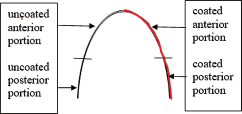 Division of the archwire.