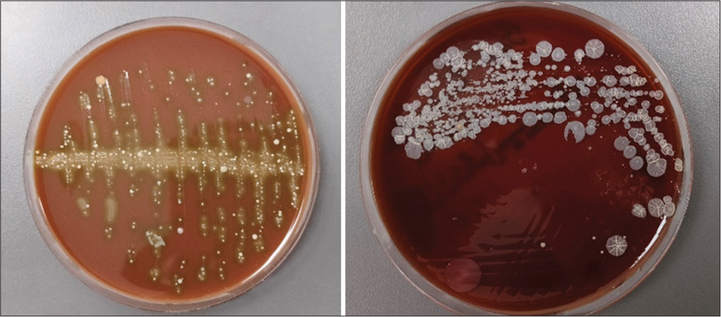 Microbial colonization.