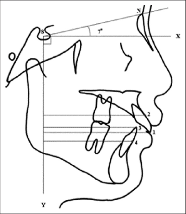 The Y-axis is defined as perpendicular to the X-axis (forming a 7° angle with the Sella nasion [SN] line downward).