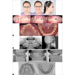 Article figure