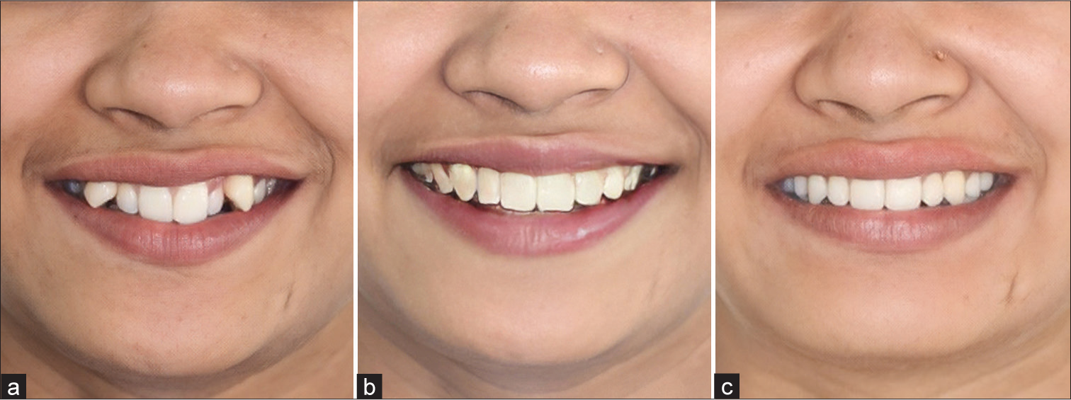 Artificial intelligence (AI) predicted image with greatest accuracy. (a) Pre-treatment image used for comparison. (b) AI predicted post-treatment image. (c) Actual post-treatment image.