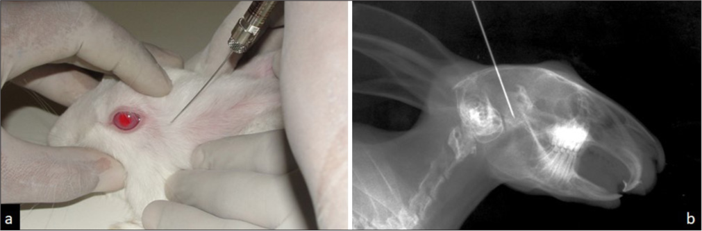 (a) Angulation of the Injection and Insertion; and (b) radiograph confirming the same.