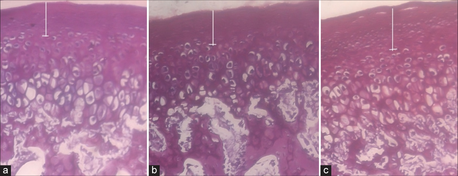 Increase in the proliferative layer as compared to the hypertrophic layer and a concomitant increase in thickness in the cartilage in experimental groups. (a) Control group treated with saline only; (b) experimental group treated with appliance only; and(c) experimental group treated with appliance and growth factor injection. (Magnification 1000X).