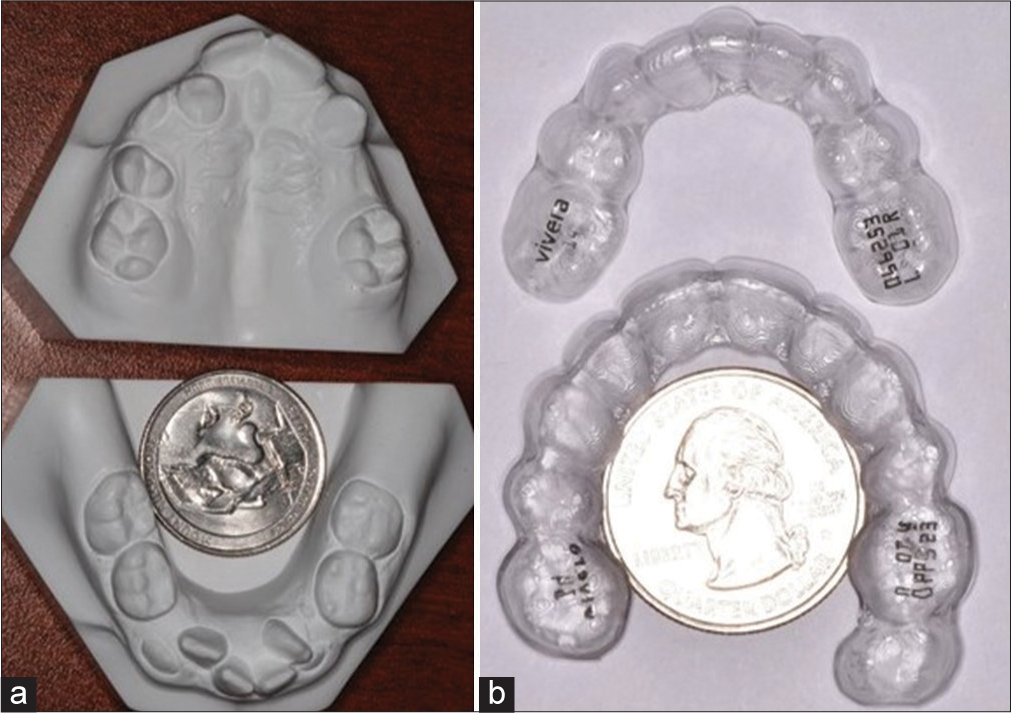 (a) Phase I pre-treatment models and (b) Phase II post-treatment retainer comparing the size of the dental arches to a United States quarter coin.