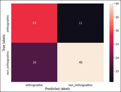 A confusion matrix illustrating classification results for orthognathic surgery cases, showing 29 true positives, 11 false negatives, 18 false positives, and 40 true negatives out of a total of 98 cases. The colors range from darker shades (indicating lower values) to lighter shades (indicating higher values), visually emphasizing the distribution of classifications.